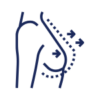 Breast Augmentation