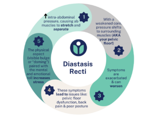 Chart illustrating the cycle of diastasis recti, including physical and mental health stressors.