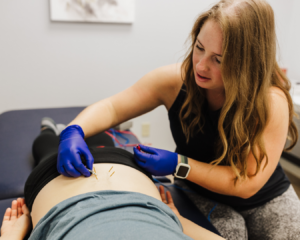 Physical therapist performing dry needling with electronic stimulation on an endometriosis patient’s back.